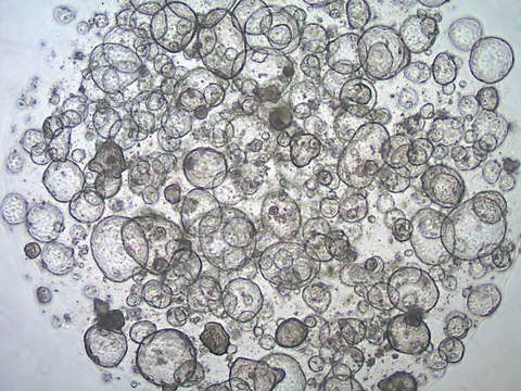 3dGRO&#174; Colon Intestinal Organoids, Age 29 (Prep 80-C) Cryopreserved patient derived gastrointestinal organoids (PDOs)