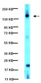 Anti-Harmartin (TSC1) Antibody ascites fluid, from mouse