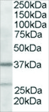 Anti-ARP2/3 subunit 1B antibody produced in goat affinity isolated antibody, buffered aqueous solution