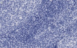 Anti-NLRP3 Antibody, clone 4B4 ZooMAb® Rabbit Monoclonal recombinant, expressed in HEK 293 cells