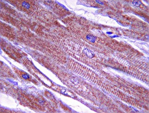 Anti-Tropomyosin Antibody, clone 15D12.2 clone 15D12.2, from mouse