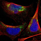 Anti-PNKD antibody produced in rabbit Prestige Antibodies® Powered by Atlas Antibodies, affinity isolated antibody, buffered aqueous glycerol solution