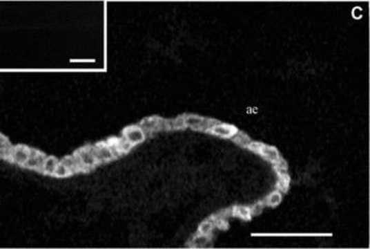 Monoclonal Anti-Cytokeratin Peptide 17 antibody produced in mouse clone CK-E3, ascites fluid