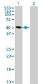 Anti-MNDA antibody produced in mouse IgG fraction of antiserum, buffered aqueous solution