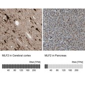 Anti-MLF2 antibody produced in rabbit Ab1, Prestige Antibodies® Powered by Atlas Antibodies, affinity isolated antibody, buffered aqueous glycerol solution