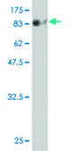 Monoclonal Anti-CHEK2 antibody produced in mouse clone 4F10, purified immunoglobulin, buffered aqueous solution