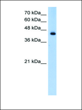 Anti-ACADL antibody produced in rabbit affinity isolated antibody