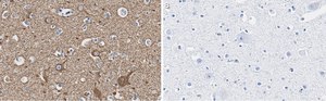Anti-Neurofilament L Antibody, clone 1E13 ZooMAb&#174; Rabbit Monoclonal recombinant, expressed in HEK 293 cells