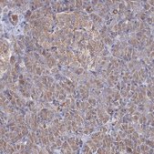 Anti-PEX13 antibody produced in rabbit Prestige Antibodies® Powered by Atlas Antibodies, affinity isolated antibody, buffered aqueous glycerol solution
