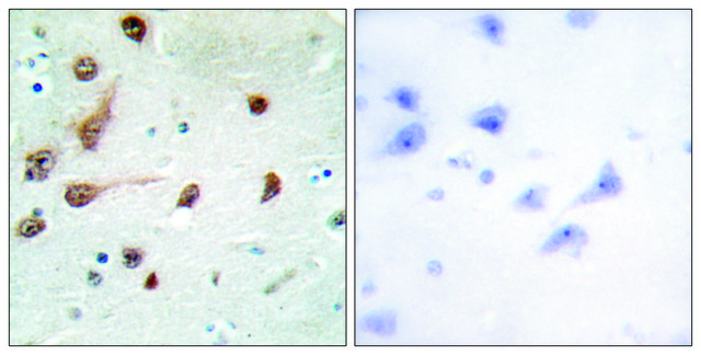 Anti-ADAR1 antibody produced in rabbit affinity isolated antibody