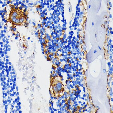 Anti-Integrin beta 3 (ITGB3/CD61) Antibody, clone 7D5N1, Rabbit Monoclonal