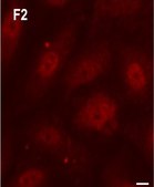Anti-Rab5 antibody, Mouse monoclonal clone Rab5-65, purified from hybridoma cell culture