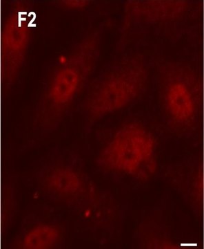 Anti-Rab5 antibody, Mouse monoclonal clone Rab5-65, purified from hybridoma cell culture