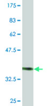 Monoclonal Anti-CHODL antibody produced in mouse clone 1A5, purified immunoglobulin, buffered aqueous solution