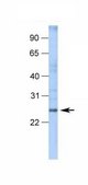 Anti-SPIB antibody produced in rabbit affinity isolated antibody