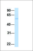 Anti-HNF1B antibody produced in rabbit affinity isolated antibody