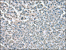Anti-PTBP1 affinity isolated antibody