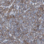 Anti-RNF182 antibody produced in rabbit Prestige Antibodies® Powered by Atlas Antibodies, affinity isolated antibody, buffered aqueous glycerol solution
