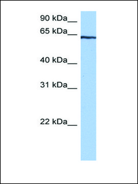 Anti-TTC6 antibody produced in rabbit affinity isolated antibody