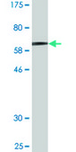 Monoclonal Anti-MAGEA11 antibody produced in mouse clone 3A6, ascites fluid