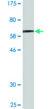 Monoclonal Anti-MAGEA11 antibody produced in mouse clone 3A6, ascites fluid