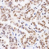 Anti-MonoMethyl-Histone H3-K4 antibody produced in rabbit