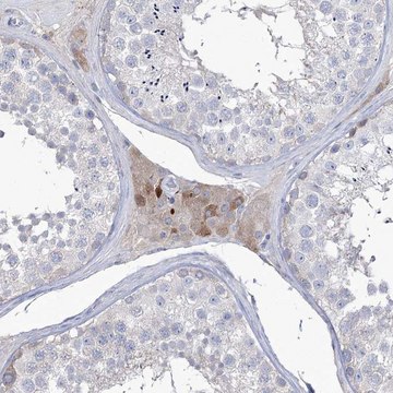 Anti-ZNF622 antibody produced in rabbit Prestige Antibodies&#174; Powered by Atlas Antibodies, affinity isolated antibody, buffered aqueous glycerol solution