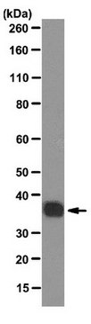 Anti-SMN2 Antibody, clone SMN-KH clone SMN-KH, from mouse