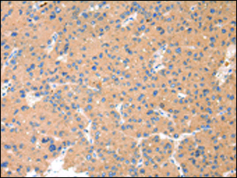 Anti-CTSK affinity isolated antibody