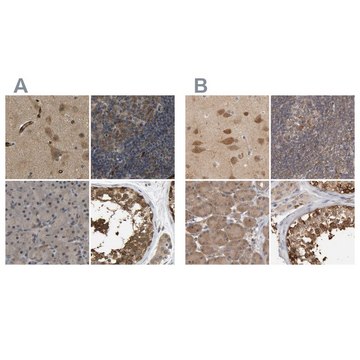 Anti-CCT8 antibody produced in rabbit Prestige Antibodies&#174; Powered by Atlas Antibodies, affinity isolated antibody, buffered aqueous glycerol solution