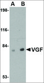 Anti-VGF antibody produced in rabbit affinity isolated antibody, buffered aqueous solution