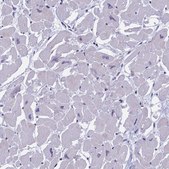 Anti-MYBPC2 antibody produced in rabbit Prestige Antibodies® Powered by Atlas Antibodies, affinity isolated antibody, buffered aqueous glycerol solution