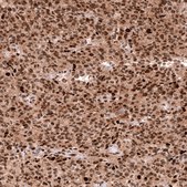 Monoclonal Anti-EZH2 antibody produced in mouse Prestige Antibodies® Powered by Atlas Antibodies, clone CL11915, purified immunoglobulin, buffered aqueous glycerol solution
