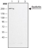 Anti-Dysferlin (N-terminal region) antibody produced in rabbit ~1.5 mg/mL, affinity isolated antibody