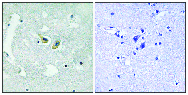 Anti-phospho-p47 phox (pSer345) antibody produced in rabbit affinity isolated antibody