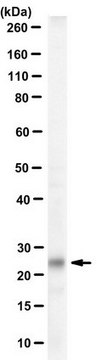 Anti-Tentonin 3/TMEM150c from rabbit