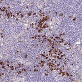 Anti-MYDGF antibody produced in rabbit Prestige Antibodies® Powered by Atlas Antibodies, affinity isolated antibody, buffered aqueous glycerol solution