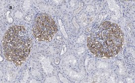 Anti-PLA2R1 Antibody, clone 1D5, ZooMAb® Rabbit Monoclonal recombinant, expressed in HEK 293 cells