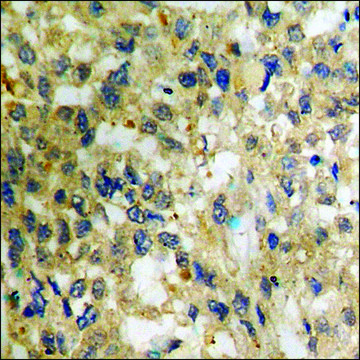 Anti-phospho-NF-kappaB p65 (pSer536) antibody produced in rabbit affinity isolated antibody