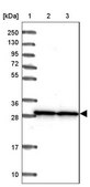 Anti-SNRPA1 antibody produced in rabbit Prestige Antibodies® Powered by Atlas Antibodies, affinity isolated antibody, buffered aqueous glycerol solution