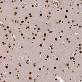 Anti-CTB-50L17.10 antibody produced in rabbit Prestige Antibodies® Powered by Atlas Antibodies, affinity isolated antibody, buffered aqueous glycerol solution