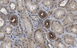 Anti-Insulin Receptor β Antibody, clone 1J16 ZooMAb® Rabbit Monoclonal recombinant, expressed in HEK 293 cells