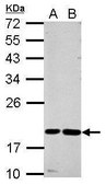 Anti-CST7 antibody produced in rabbit affinity isolated antibody, buffered aqueous solution