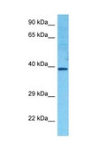 Anti-HOXC11 (AB2) antibody produced in rabbit IgG fraction of antiserum