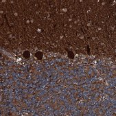 Anti-TRIM7 antibody produced in rabbit Prestige Antibodies® Powered by Atlas Antibodies, affinity isolated antibody, buffered aqueous glycerol solution