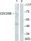Anti-CDC25B antibody produced in rabbit affinity isolated antibody