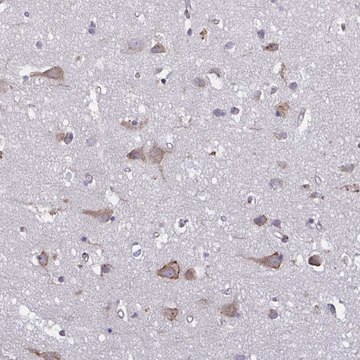 Anti-TMEM8C antibody produced in rabbit Prestige Antibodies&#174; Powered by Atlas Antibodies, affinity isolated antibody, buffered aqueous glycerol solution