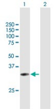 Anti-UPK3B antibody produced in mouse purified immunoglobulin, buffered aqueous solution