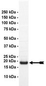 UbcH5c Protein, active, 10 µg Active, full length, recombinant human UbcH5c. N-terminal HA, 6His-tagged. For use in Enzyme Assays. Functions as an E2 enzyme in ubiquitination assays.