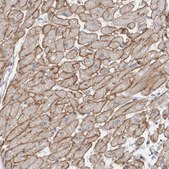 Anti-DMD antibody produced in rabbit Prestige Antibodies® Powered by Atlas Antibodies, affinity isolated antibody, buffered aqueous glycerol solution